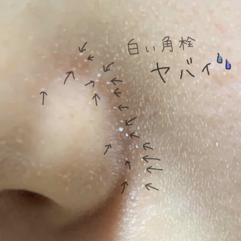 本水橋保壽堂去黑頭噴霧 Emulsion Remover