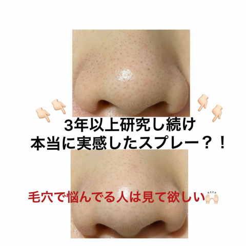 本水橋保壽堂去黑頭噴霧 Emulsion Remover