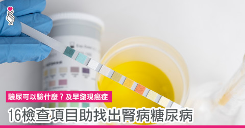 驗尿可以驗甚麼